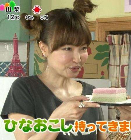 【整形】加齢によるたるみを取りたい