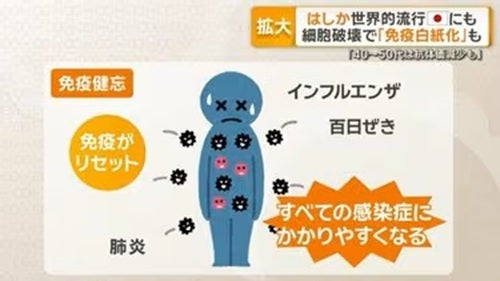 【ウイルス感染症】麻疹(はしか)について知っていること
