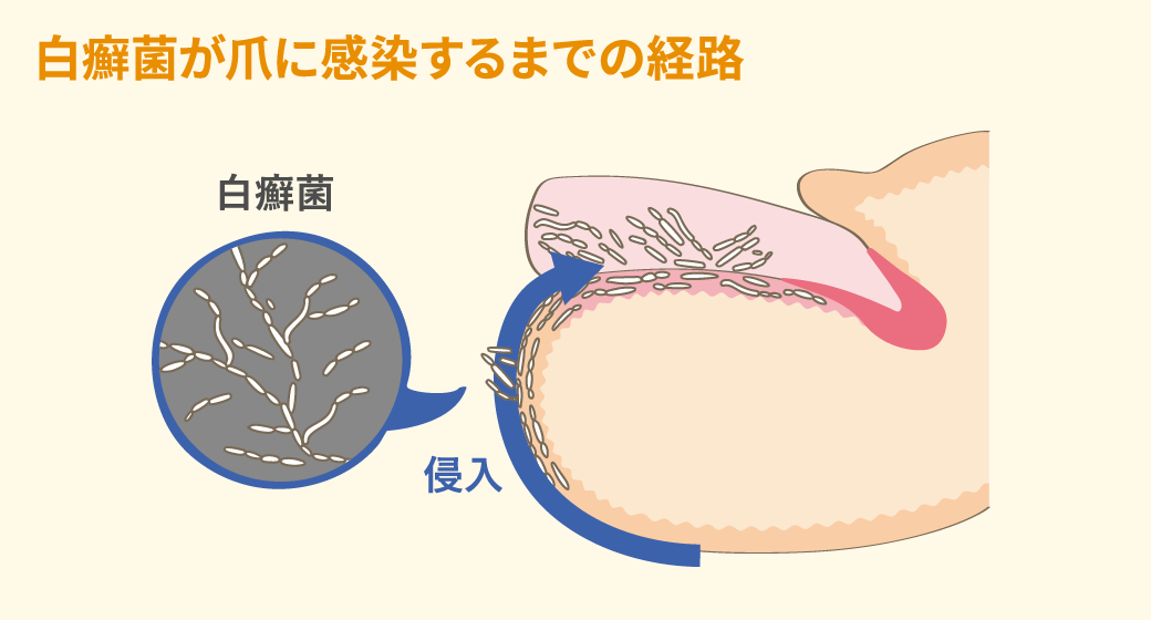指しゃぶりがやめられない。