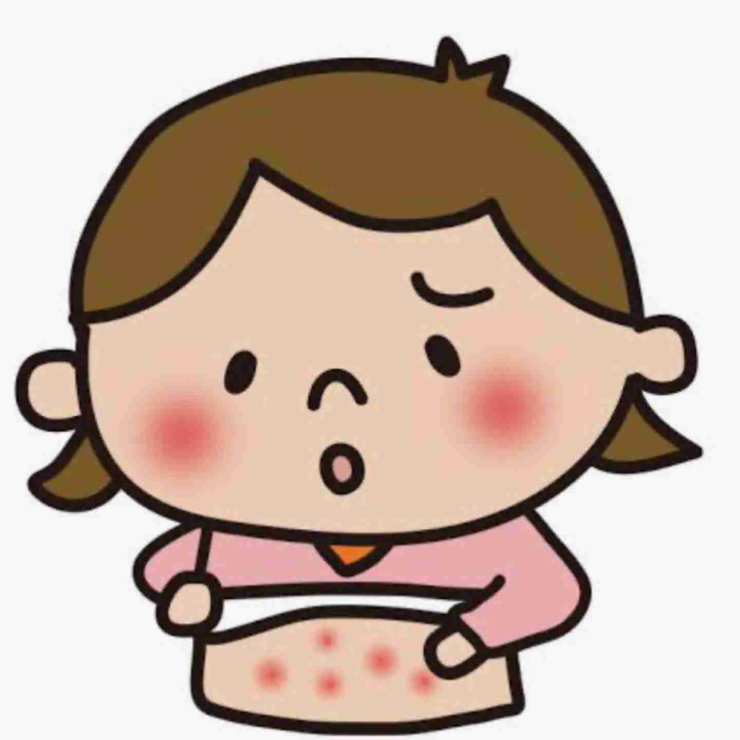 ストレスによる蕁麻疹の症状写真