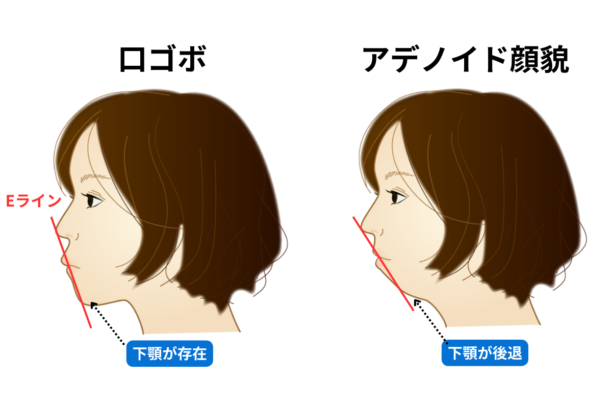 《新時代の美人基準》 とSNSで “名指し” された、実力派の若手女優（23）…　もはや美人に “あご” は要らない？　令和の「あご不要論」とは
