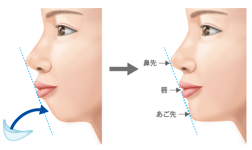 《新時代の美人基準》 とSNSで “名指し” された、実力派の若手女優（23）…　もはや美人に “あご” は要らない？　令和の「あご不要論」とは