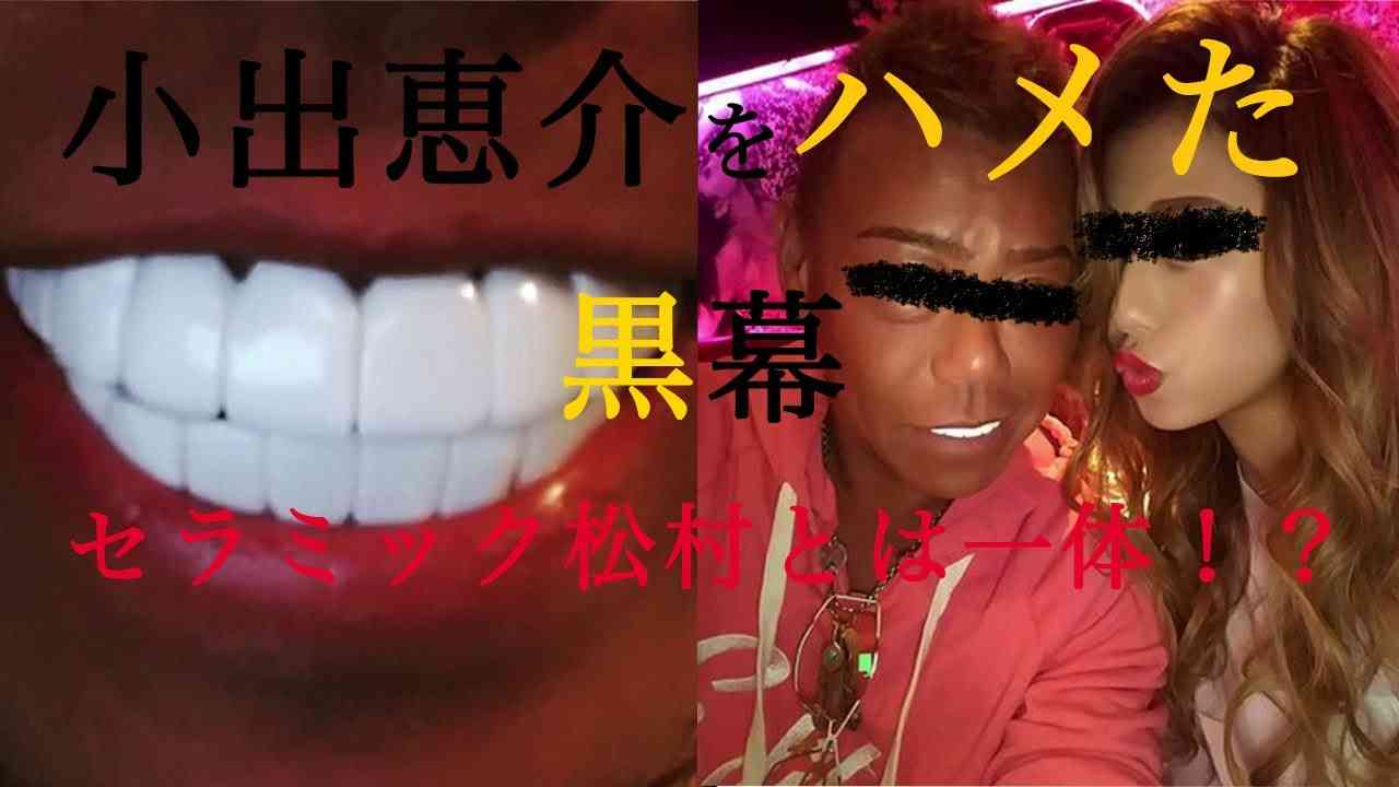 小出恵介　42歳「島暮らし」近影に騒然　「金髪じゃん!!」「チャラ男」「痩せた」