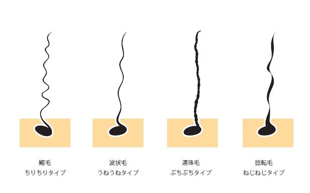 くせ毛・パヤ毛の種類（縮れ毛・波状毛・捻転毛・捻縮毛）