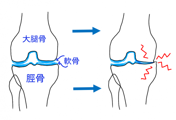 1日1万歩はもう古い？　実は健康効果は8000で頭打ち…歩き方次第で太る恐れも　正しいウオーキング術とは