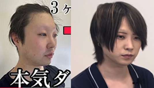 「別人だ」元No.1ホスト・はてにゃんの“ビフォーアフター”にネット衝撃 デート中にすっぴん披露