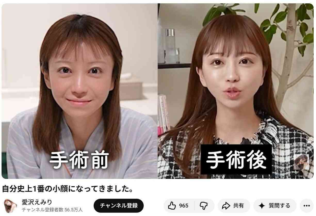 美容整形して後悔した方、語りましょう