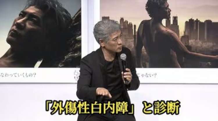 吉川晃司 左目の失明危機で緊急手術 2公演の延期を発表 手術成功も「激しい運動控える制限があるため」