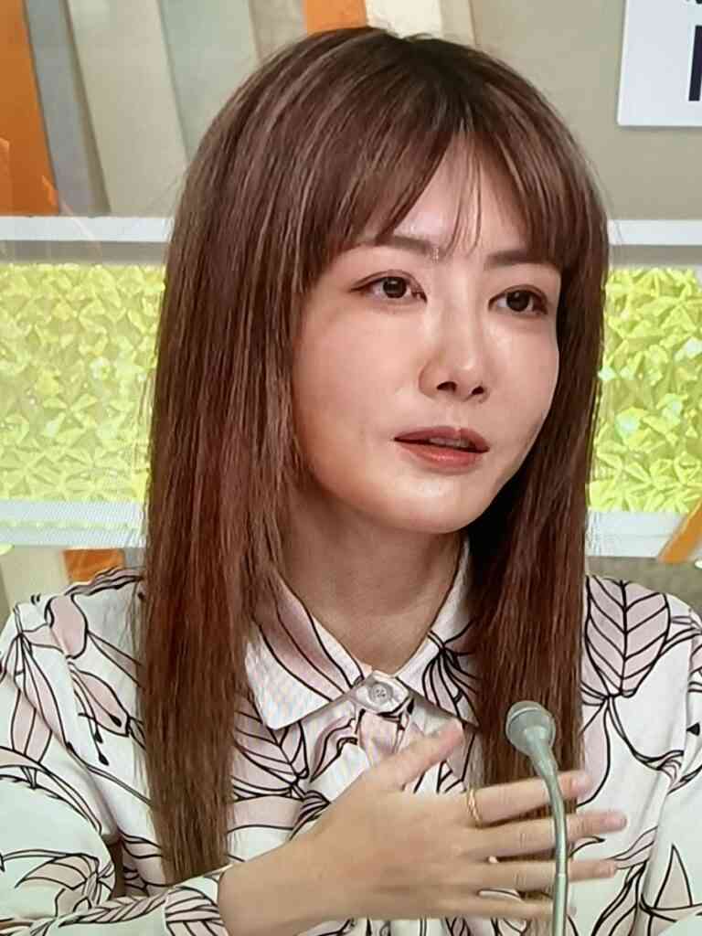 ボトックス失敗