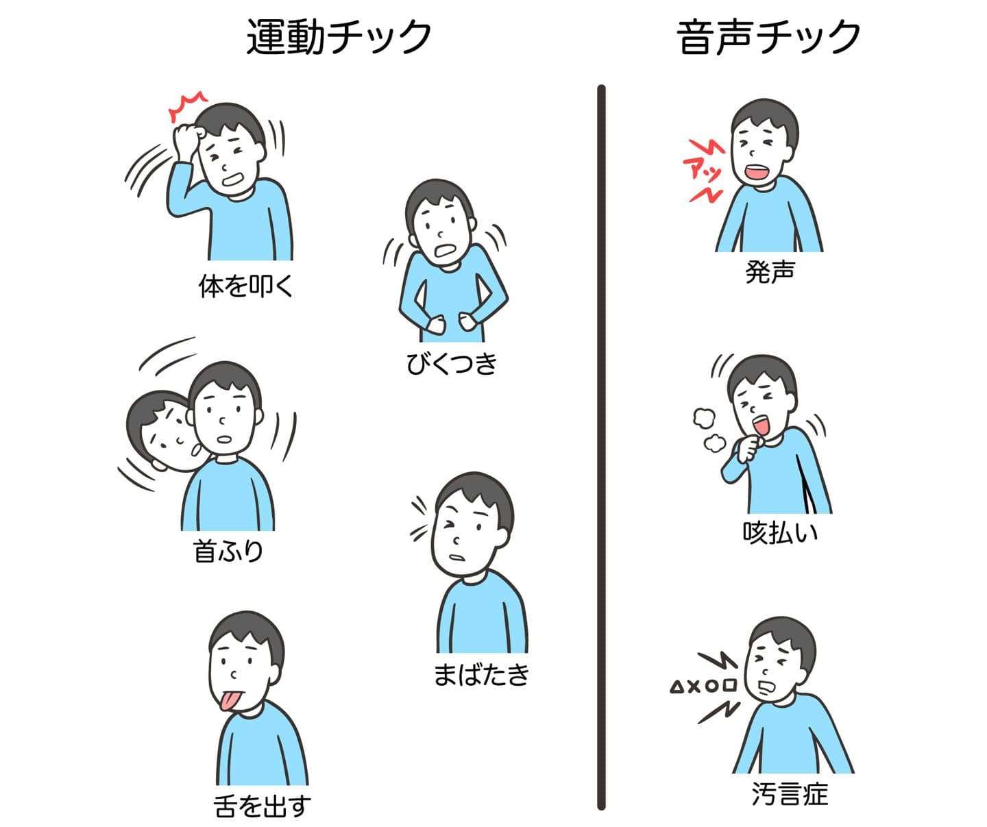 チックの症状の期間