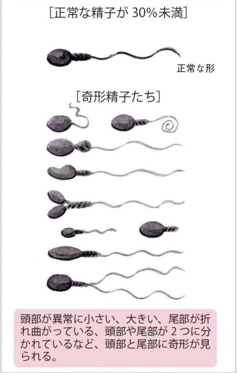 40～45歳で一気に老けるという先人のメッセージをひとつひとつ実感している今…白髪、太る、老眼「人間は緩やかに老いるのではない、老いに突き落とされるのだ」