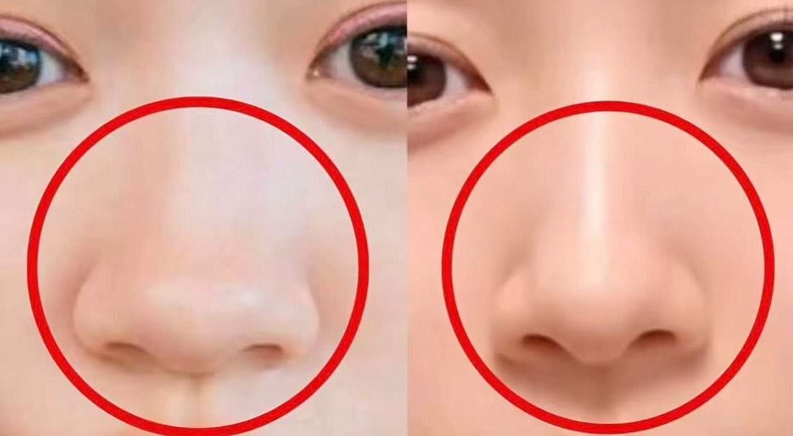 「高い鼻」 はもう古い…？　「《忘れ鼻》になりたい」切望する女性たち　令和 “新・美の基準”、そのワケを解説