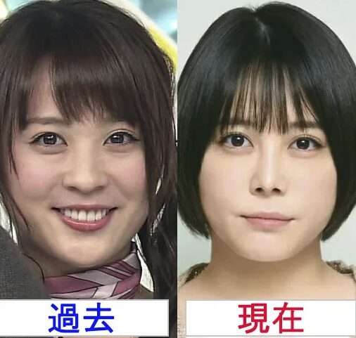 鼻の形による顔の印象の違い比較画像
