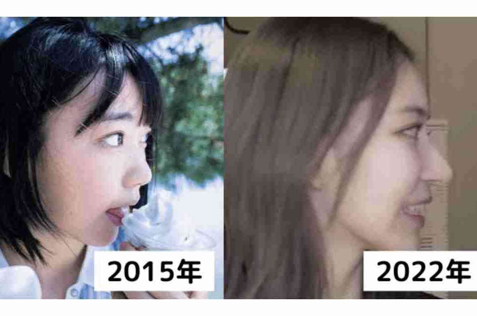 「高い鼻」 はもう古い…？　「《忘れ鼻》になりたい」切望する女性たち　令和 “新・美の基準”、そのワケを解説
