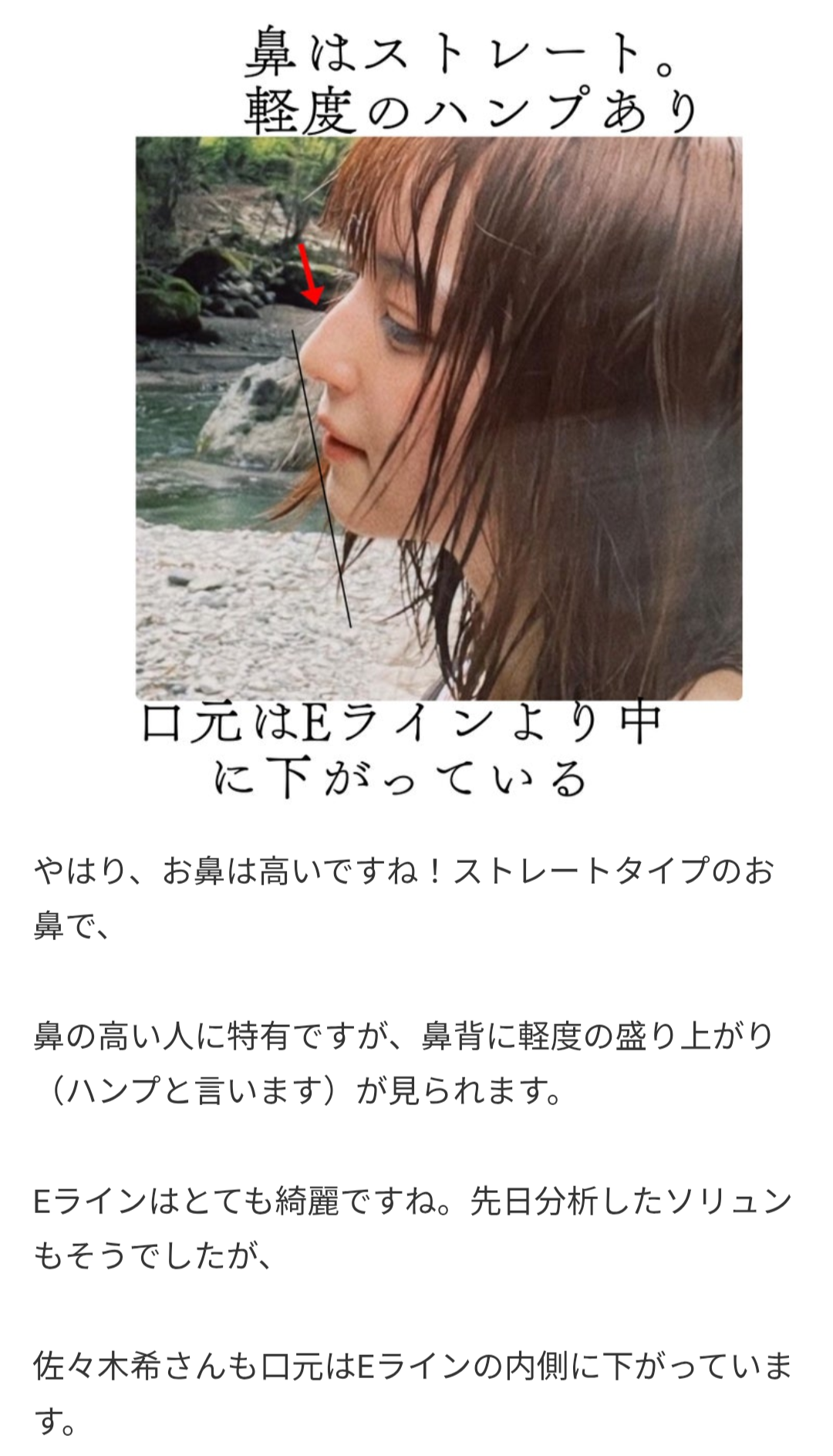 【顔面】エラってあった方が綺麗じゃない？