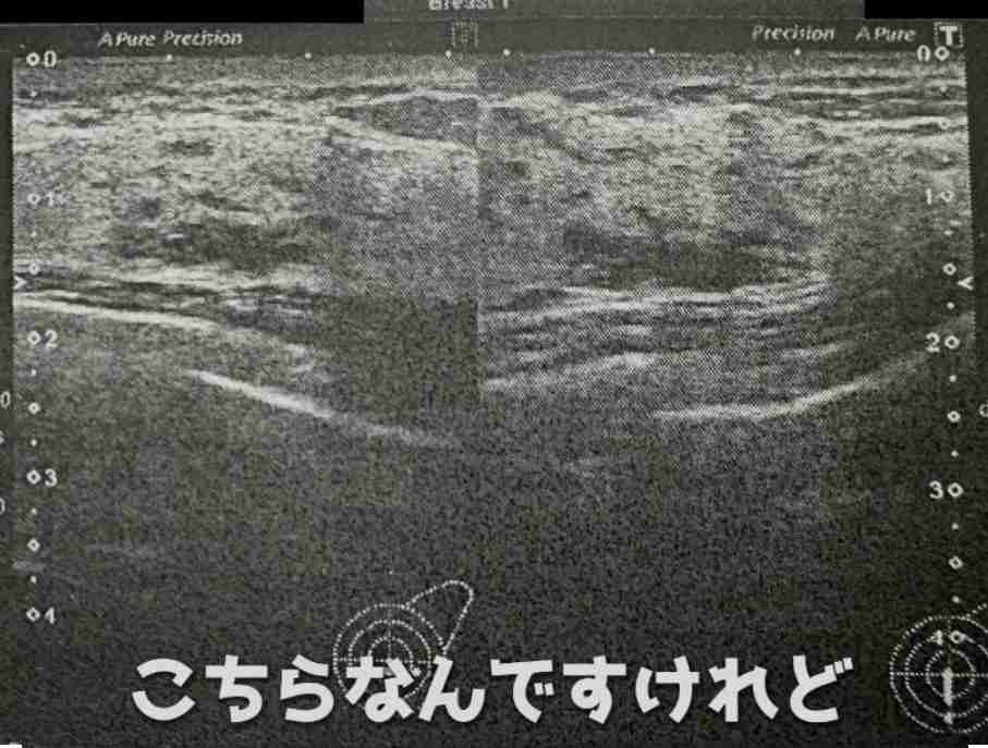 ゼロだと嬉しいこと