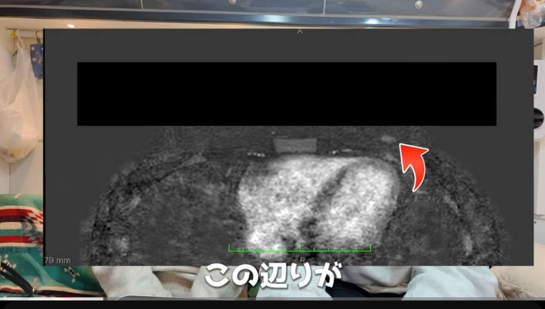 ゼロだと嬉しいこと