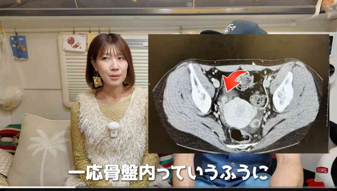 ゼロだと嬉しいこと