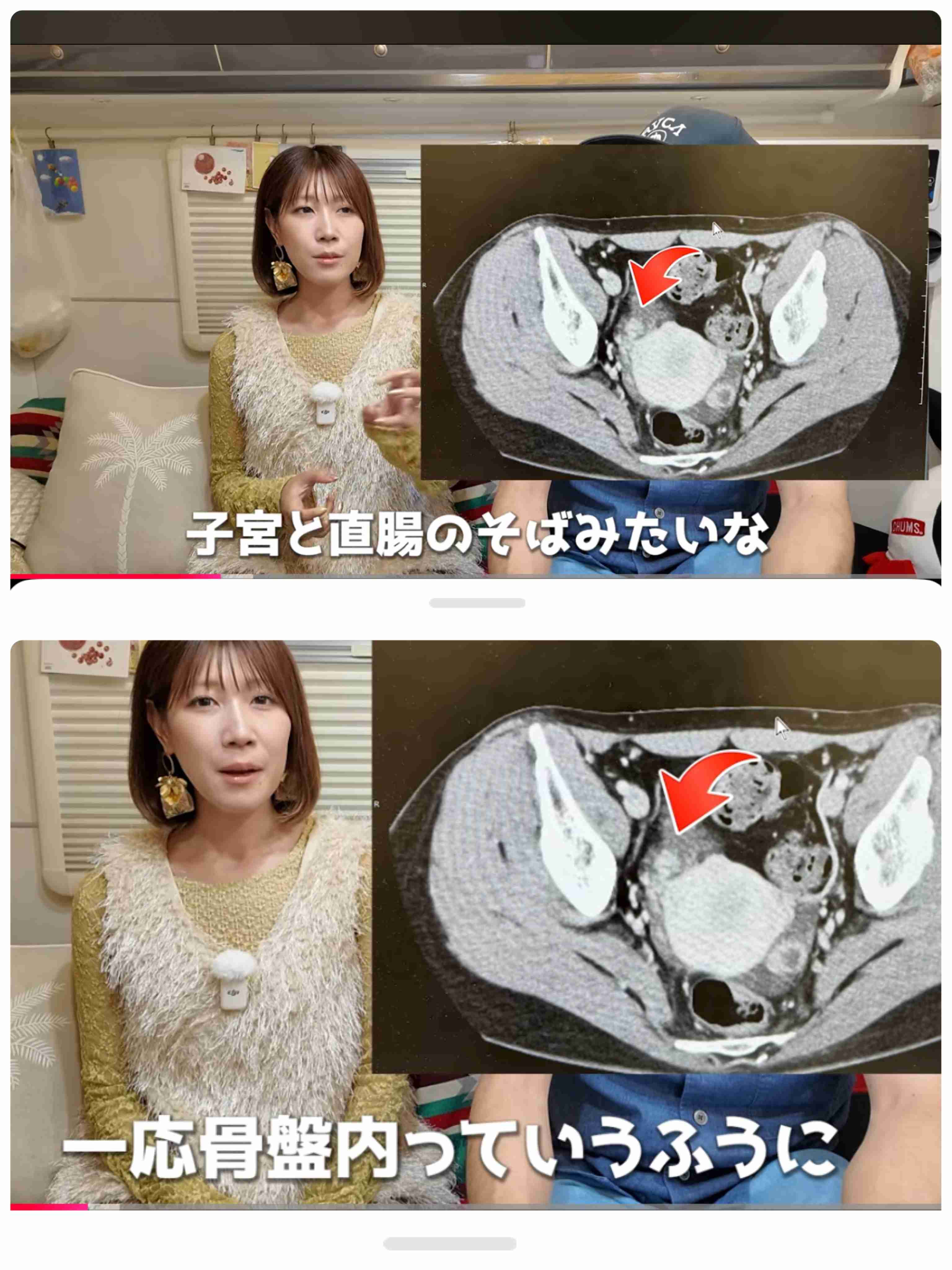ゼロだと嬉しいこと