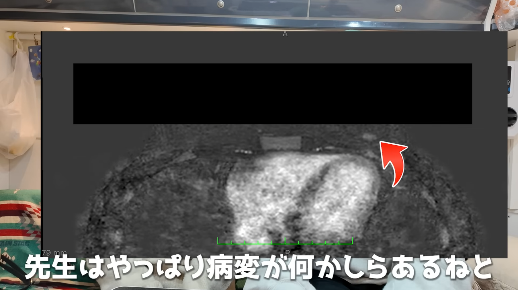ゼロだと嬉しいこと