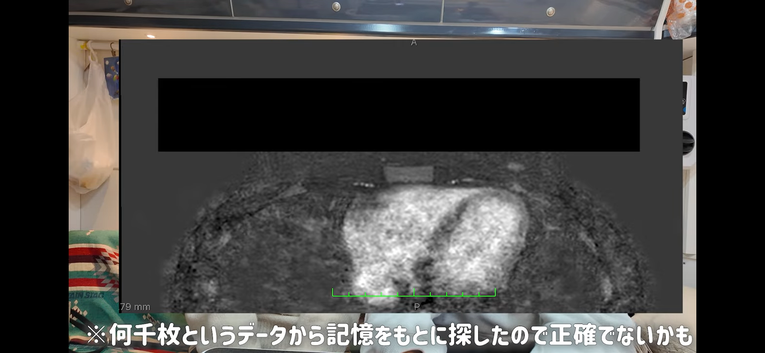 ゼロだと嬉しいこと