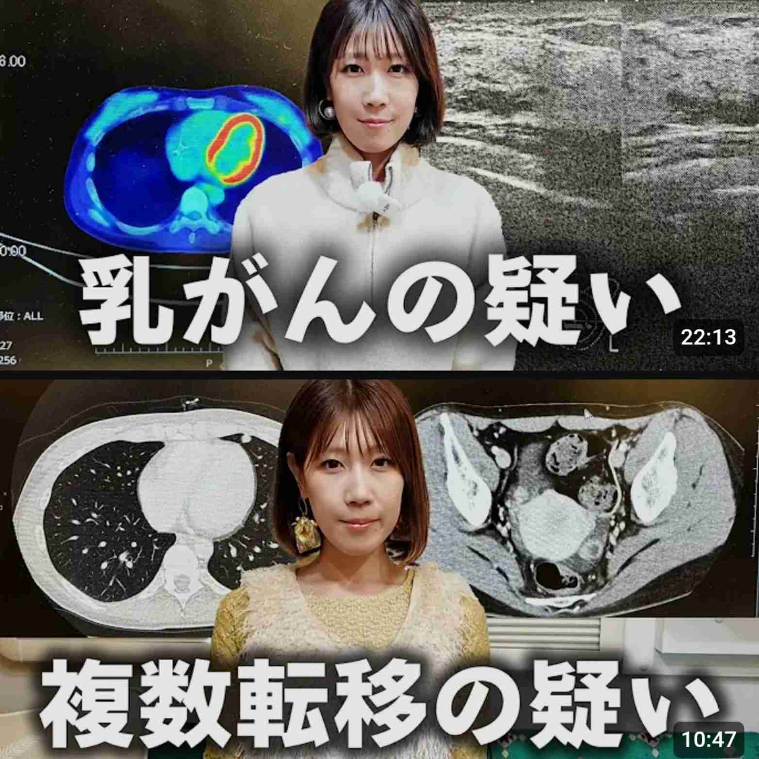 ゼロだと嬉しいこと