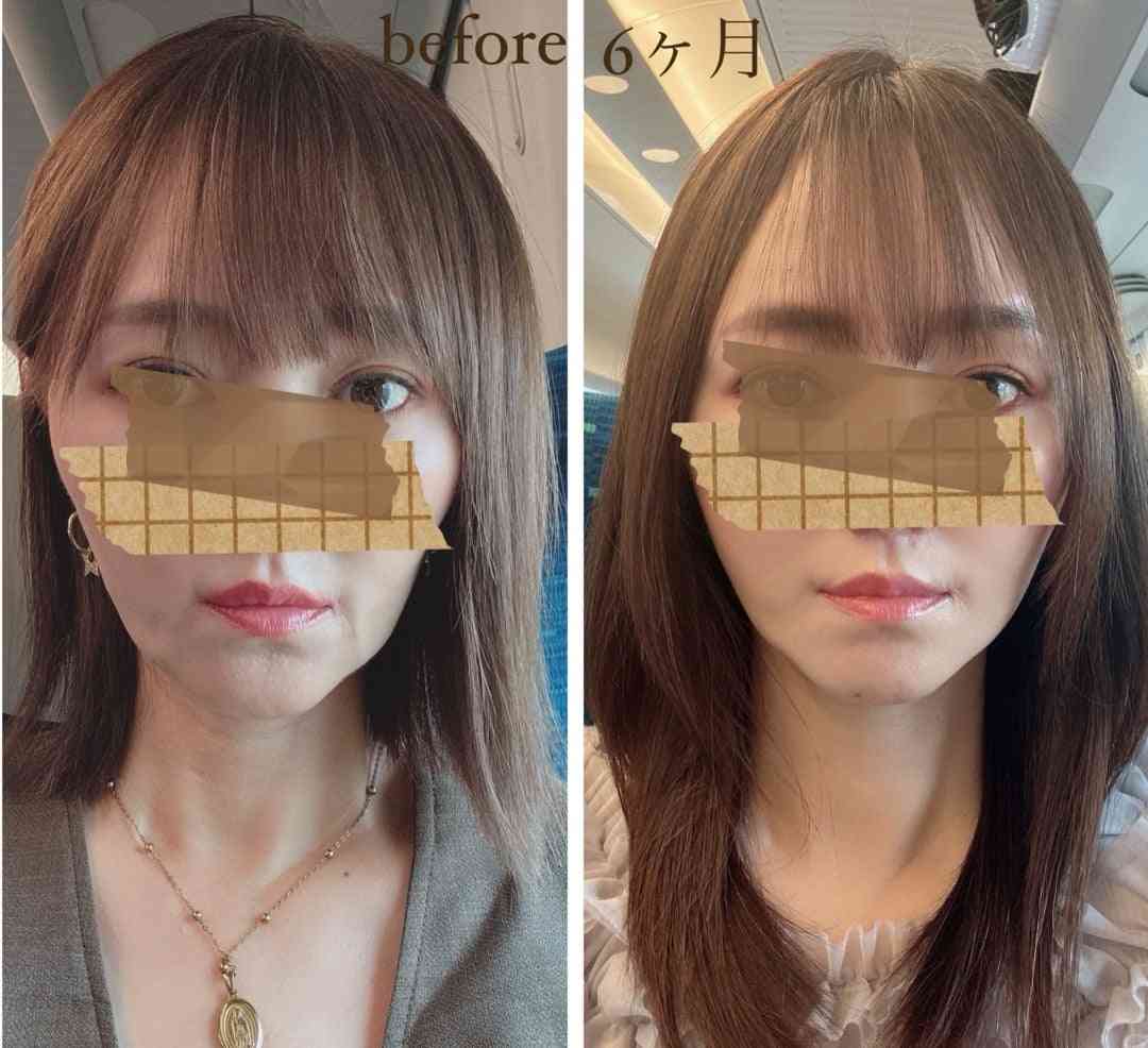 自分の老け方に気付いてないのは私だけ?