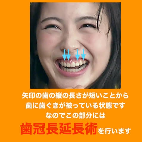 一般人の美形の割合