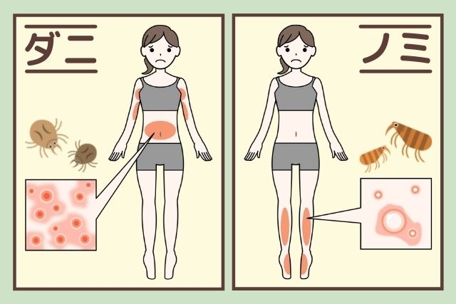 【ダニ】刺されまくり！【ノミ】