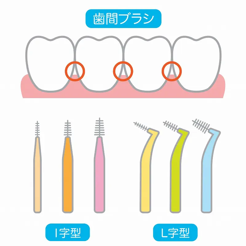 銀歯ではなく“白い歯”のブリッジ、初の保険適用で治療費3割安く 樹脂製の歯科材料「SHIN-BOW」が担う歯科治療の未来【YAMAKIN開発】