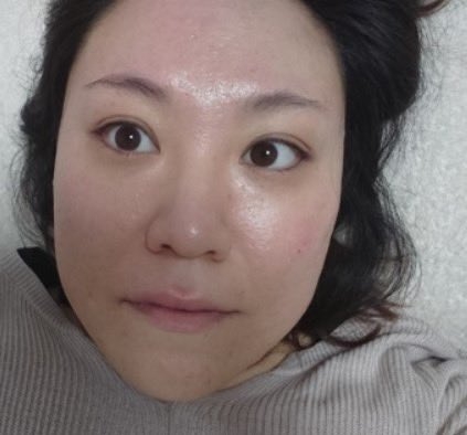 肌が汚い人のファンデーション