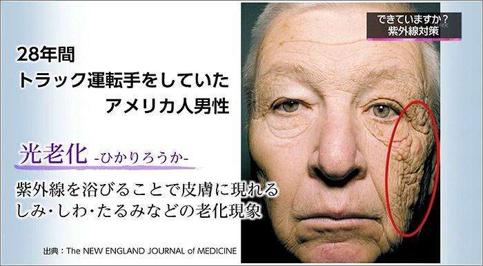 日焼けが嫌で仕事辞めたい