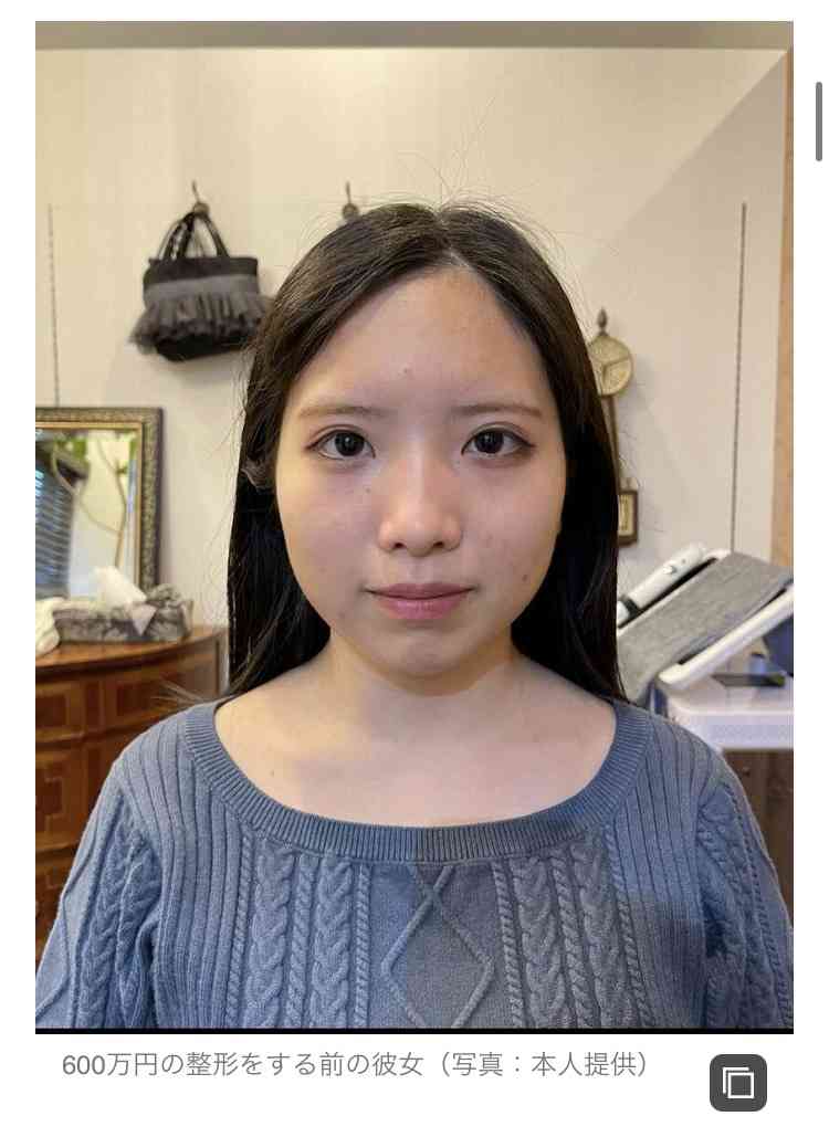 「整形して量産型の顔になってるじゃねーか笑笑」それでも“今の自分”が好き…《整形総額600万》24歳・元アイドルが【誹謗中傷に負けない理由】