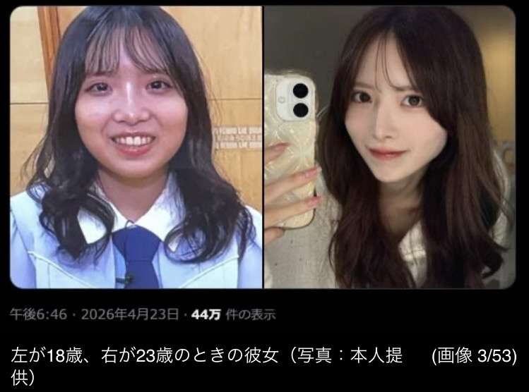 「顔が悪いから人気がないんだ」10代アイドルが【36キロ・ガリガリ体型】に⋯彼女を追い詰めた「握手会の闇」