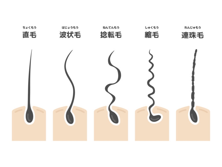 くせ毛の種類説明図(波状毛・縮毛・連珠毛など)