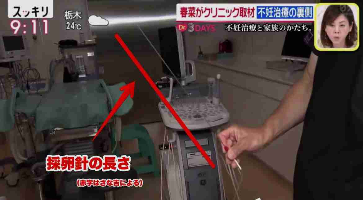 自分は子供はあまり望んではいなく、旦那が望んでる。それで実際に子供を作った方、いませんか?