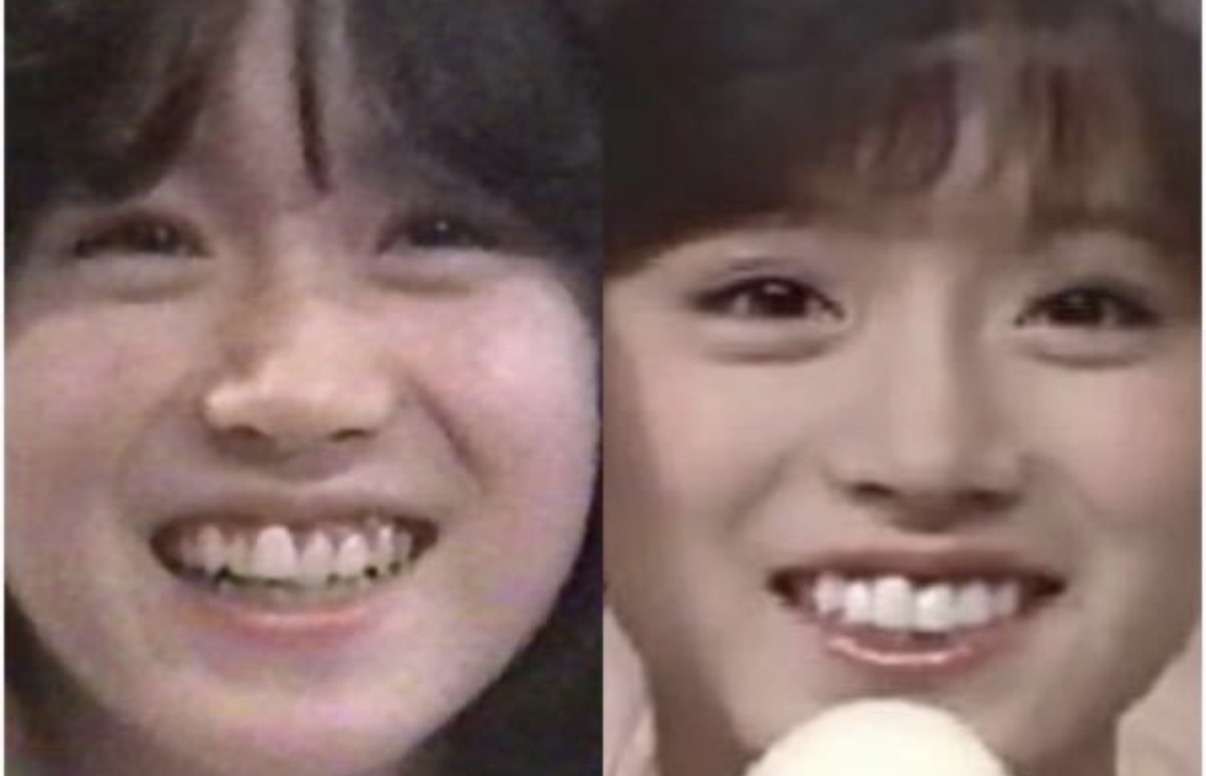 最近の芸能人はなぜあんなに歯並びがいいの?