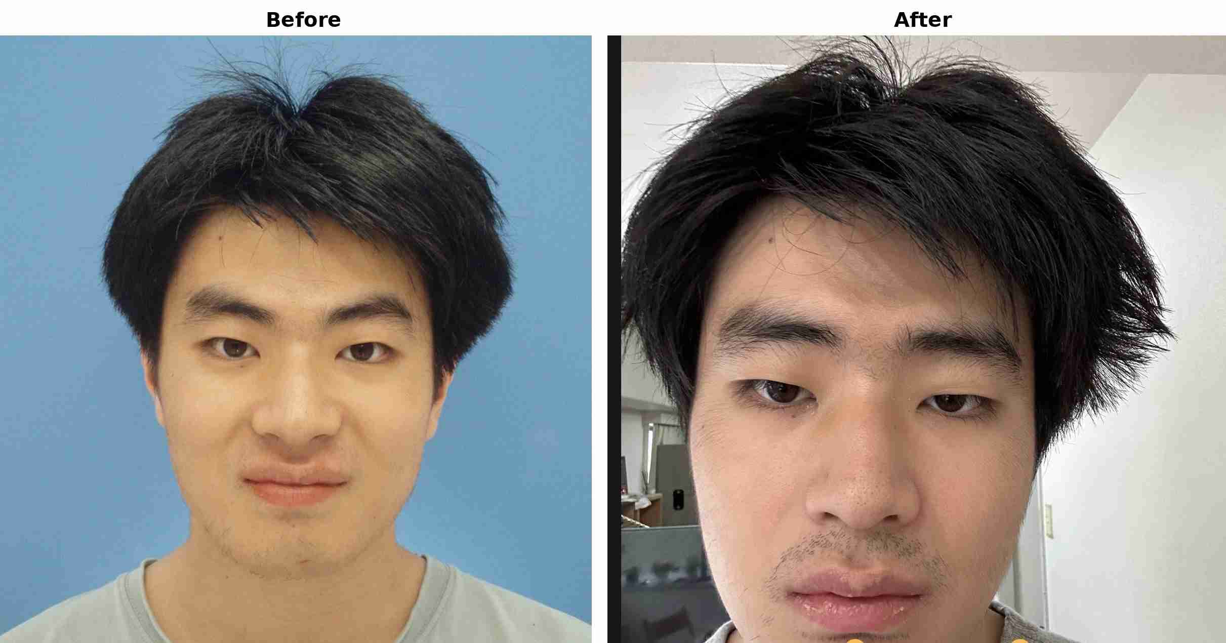 美人からブスになった人