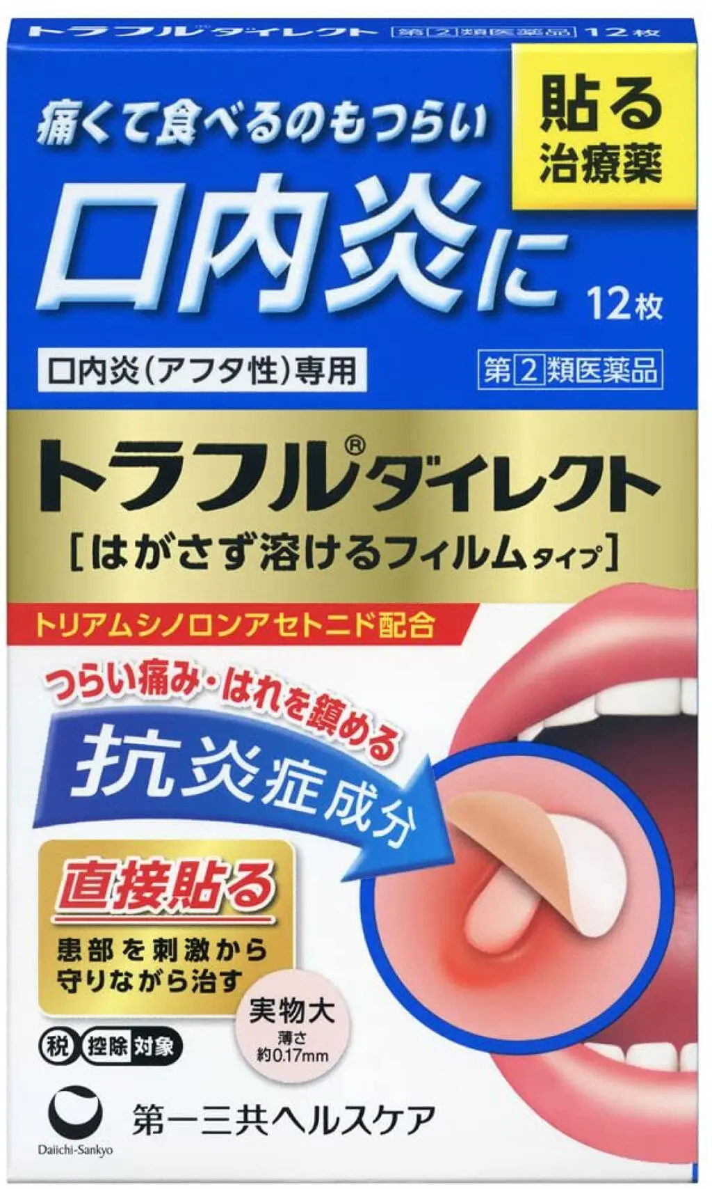 《助けて》口内炎が痛すぎる