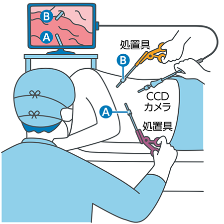 ゼロだと嬉しいこと