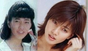 若い頃整形しなくて良かった