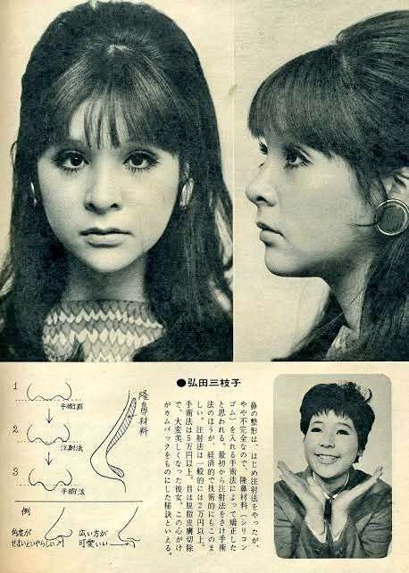 若い頃整形しなくて良かった