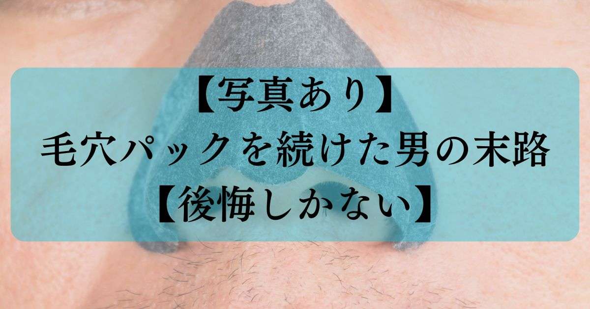 鼻パック後遺症で悩んでる方
