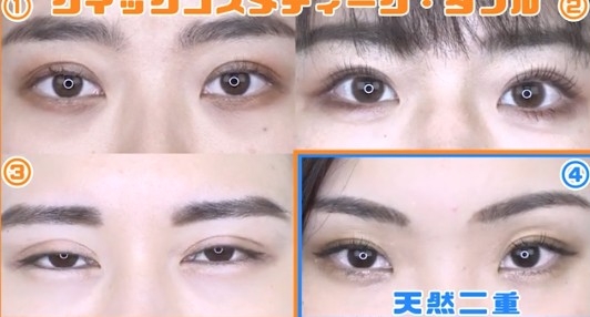 整形した事ある人にしか分からない不調