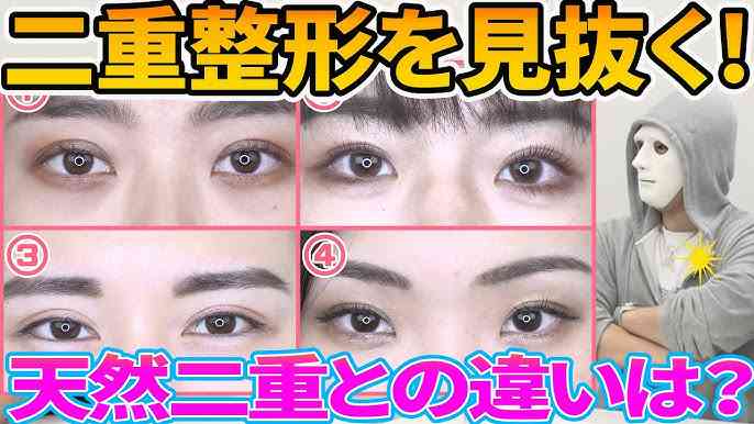 整形した事ある人にしか分からない不調
