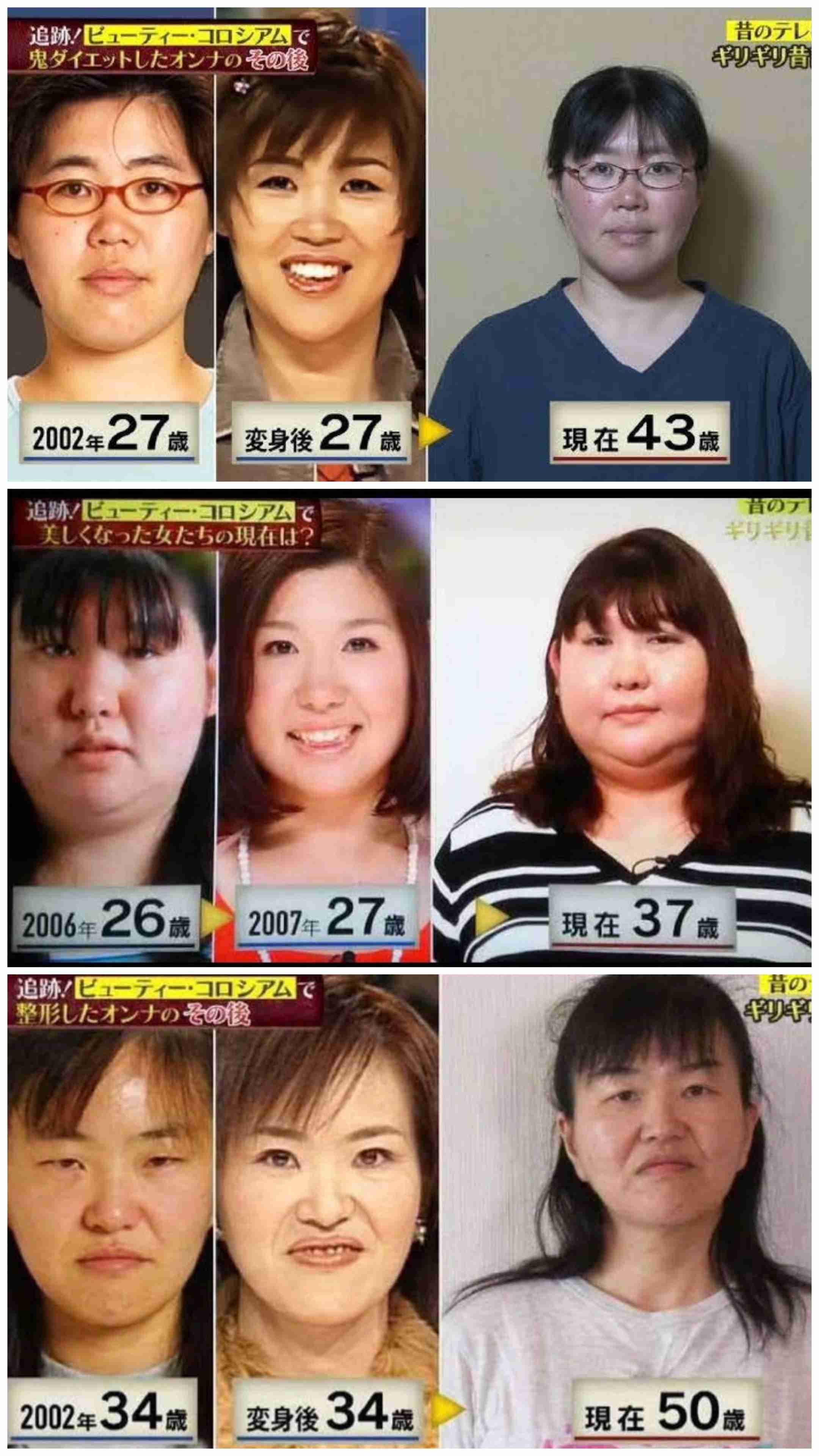整形した事ある人にしか分からない不調
