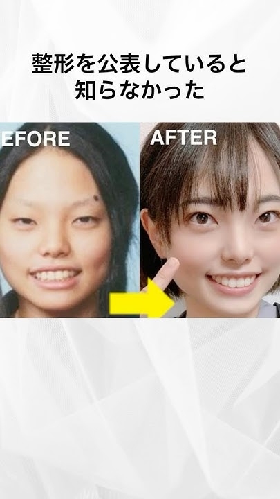 整形した事ある人にしか分からない不調