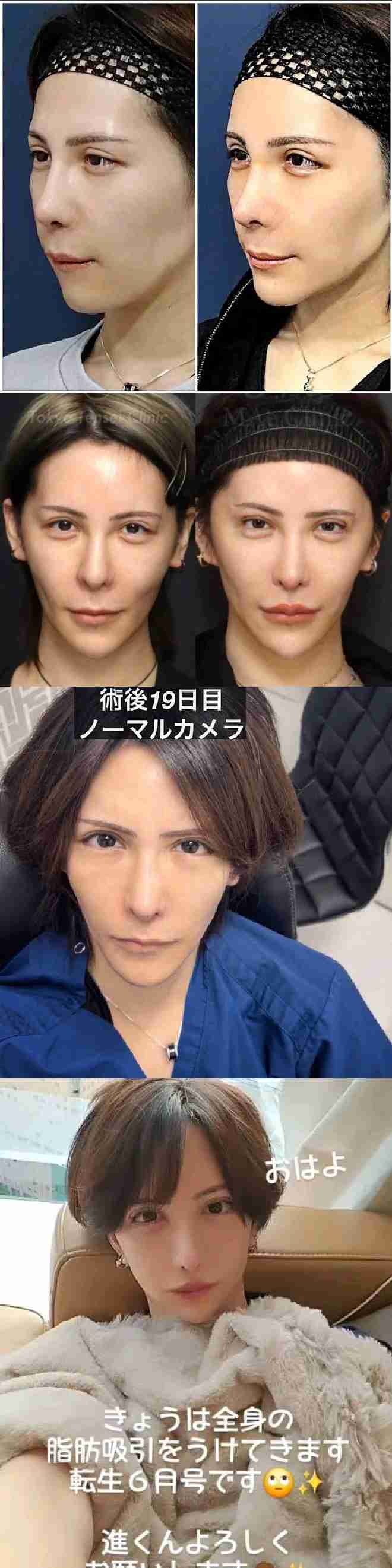 カリスマ美容外科医・辻大成氏、女性トラブルを謝罪「配慮を欠いた言動」 未成年への犯罪行為は否定