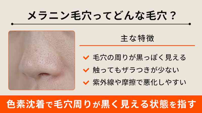 メラニン毛穴で悩んでいる人〜…【改善方法】