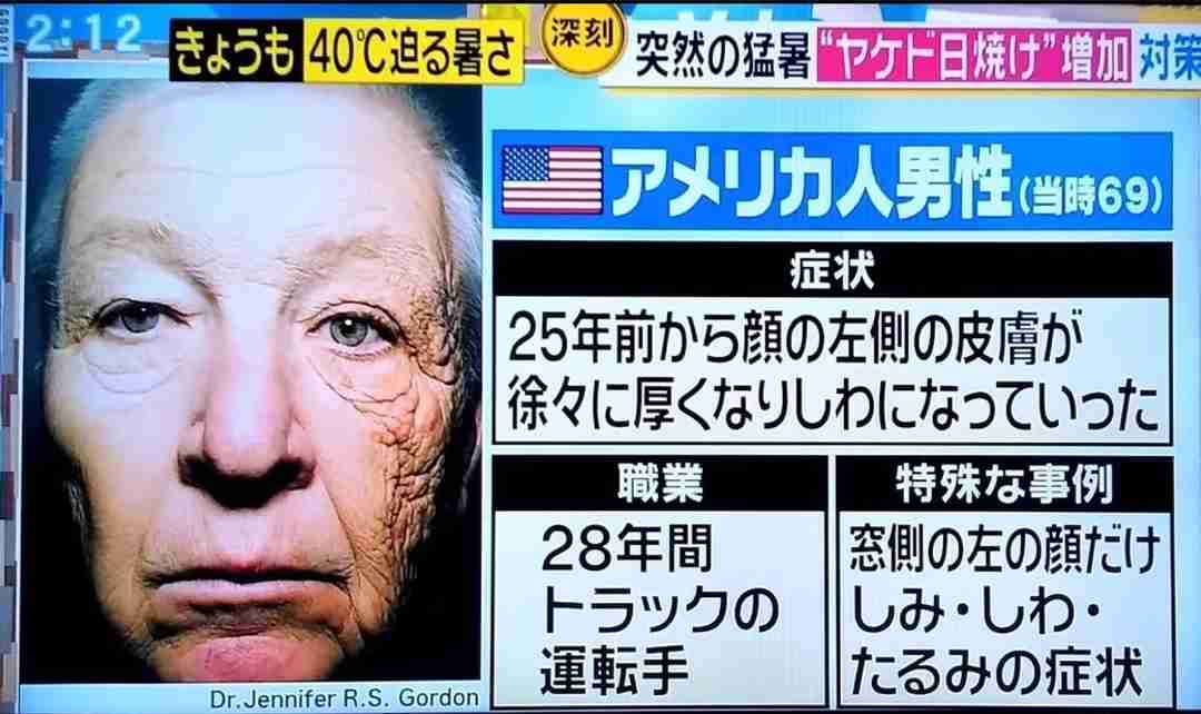 オカリナ 41歳、体の変化に悲鳴 「お金かけても取り返しつかない」「予防が一番大事」切実訴え